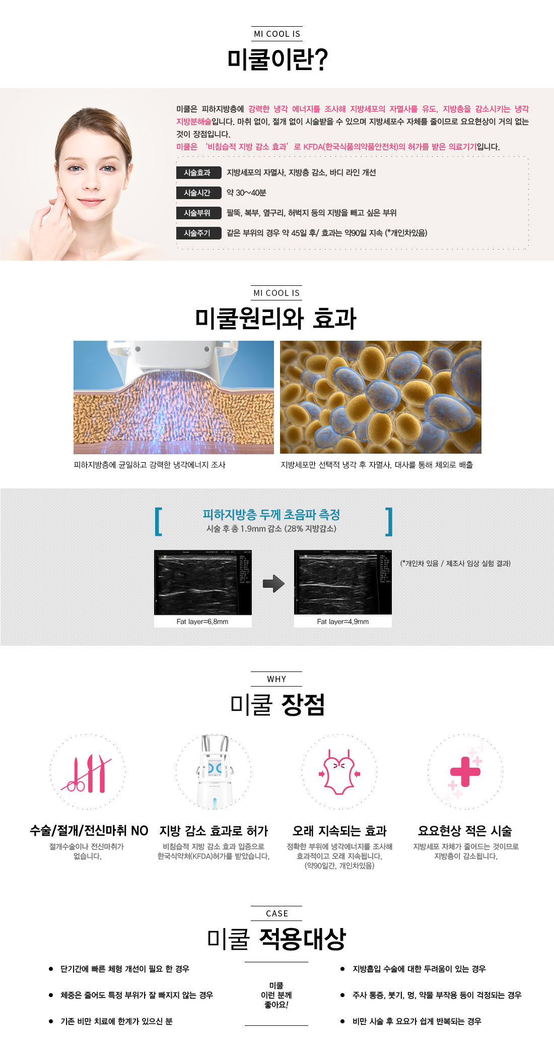 냉동지방분해술