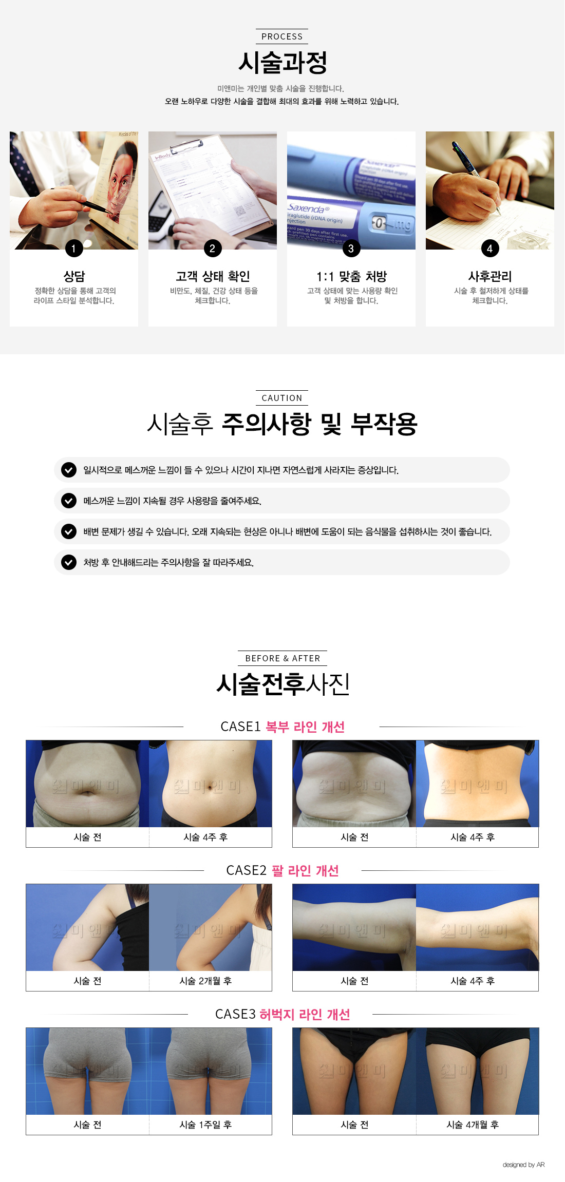 삭센다 설명