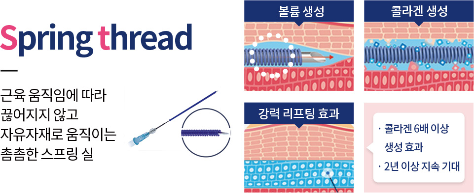근육 움직임에 따라 끊어지지 않고 자유자재로 움직이는 촘촘한 스프링 실 서울대입구피부과 깨끗한 변화를 만나는 서울대입구피부과 미앤미