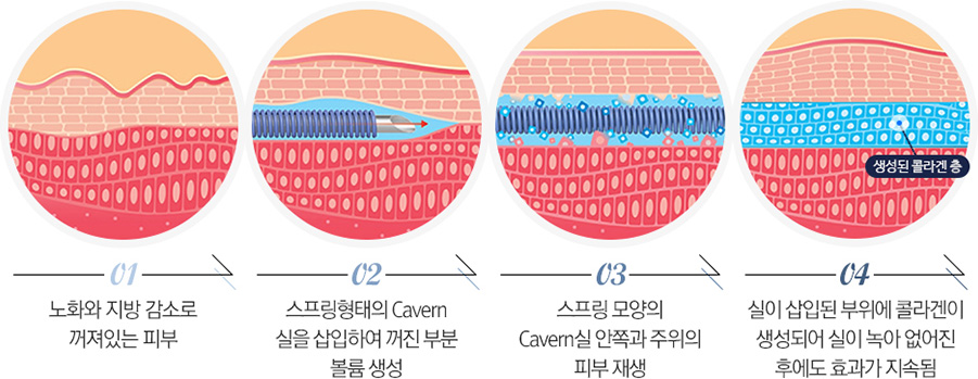 서울대입구피부과 깨끗한 변화를 만나는 서울대입구피부과 미앤미