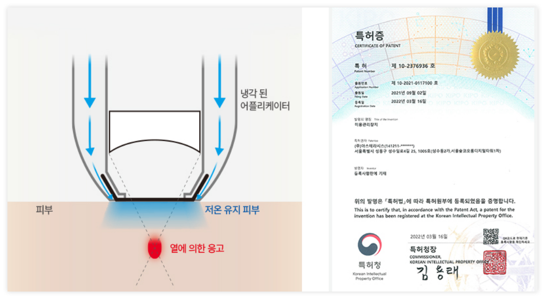 특허받은 어플리케이터로 과열방지